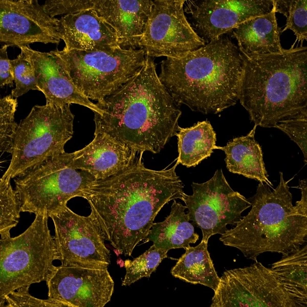 Fig. 2. c) photograph of stained A549 cells (4 channels)